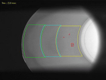 マシンビジョンにおける画像処理の3ステップ 対象物の画像をデジタルデータとして取り込み、アルゴリズムで解析、処理結果に基づいて装置を制御する