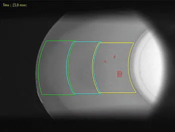 マシンビジョンにおける画像処理の具体的なステップ カップ容器の内面を検査しているモノクロ画像